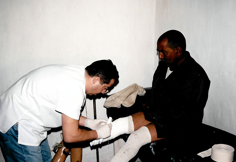 Rafael López haciendo un molde a uno de los refugiados para su prótesis (año 2000)